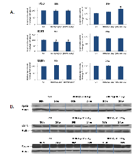 Figure 4:  The levels of Tp53, E2F3 and transgelin protein in the rat mammary gland upon whole-body irradiation. 