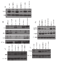 Figure 2:  Impact of silencing of MDA-9/Syntenin in HNSCC cells. 