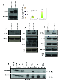 Figure 3:  Effect of MDA-9/Syntenin overexpression on immortalized oral keratinocytes. 