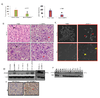 Figure 4:  Effect of MDA-9/Syntenin depletion on tumor growth and differentiation of HNSCC cells. 