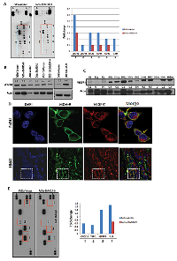 Figure 6:  Impact of MDA-9 depletion on angiogenesis of HNSCC. 