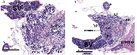 Figure 1: Prostate histology (H&E) from 25day old wild type (A) and Id4 knockout (Id4-/-) mice. 