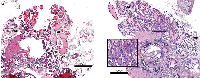 Figure 3:  Prostate histology (H&E) from 6month old wild type (A) and Id4 knockout (Id4-/- ) mice. 