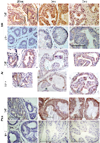 Figure 4:  Immuno-histochemical localization of Id4 (top panel), androgen receptor (Ar, middle panel), and Pten  (bottom panel) in Id4-/-  (Id4 knockout) and wt (wild type) prostates from 25d, 3m and 6m old mice. 