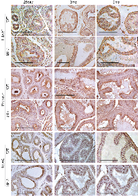 Figure 6:  Immuno-histochemical localization of Fkbp51 (top panel), Probasin (middle panel) and Fkbp52 (bottom  panel) in Id4-/-  (Id4 knockout) and wt (wild type) prostates from 25d, 3m and 6m old mice. 