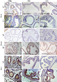 Figure 7:  Immuno-histochemical localization of Nkx3.1 (top panel), Amacr (middle panel), and Sca1 (bottom panel)  in Id4-/-  (Id4 knockout) and wt (wild type) prostates from 25d, 3m and 6m old mice. 