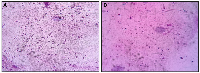 Figure 5: Representative images of semen smears stained with Diff-Quik for sperm morphology assessment at 400× magnification.