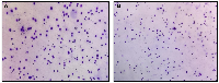 Figure 6: Representative sperm chromatin dispersion (SCD) assay images from infertile male patients were analyzed using a Halosperm® kit and visualized under bright-field microscopy at 400× magnification.