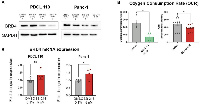 Figure 2: SB-216 significantly reduced the protein expression of BRD 4 and disrupts oxygen consumption in pancreatic cancer cells.