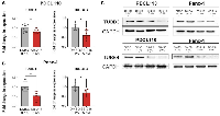 Figure 3: SB-216 significantly reduces mRNA expression of oncogenic tubulin subtypes &beta;III and &beta;IVB and protein expression of &beta;III.