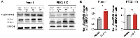 Figure 4: SB-216 induces autophagy in pancreatic cancer cells.