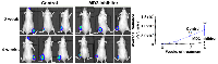 Figure 1: Effectiveness of MD2 inhibitor therapy on tumor growth in a prostate cancer bone metastasis model. 