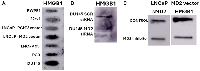 Figure 2:  Dot blot analysis of HMGB1 and soluble MD2 (sMD2) in conditioned media (CM) from prostate cancer cell  lines. 