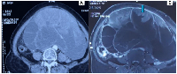 Figure 1: Radiological imaging of the abdominal lesion. 